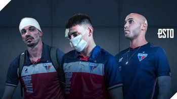 Seis futbolistas del Fortaleza de Brasil heridos en ataque de fanáticos a su autobús Seis futbolistas del Fortaleza de Brasil heridos en ataque de fanáticos a su autobús