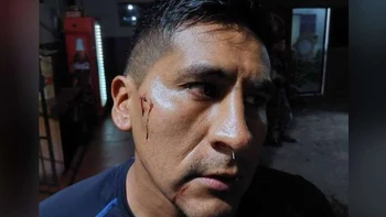 Agresión a árbitro William Medina: Policía investiga de oficio y cita a dirigentes de Blooming y a barras bravas Agresión a árbitro William Medina: Policía investiga de oficio y cita a dirigentes de Blooming y a barras bravas