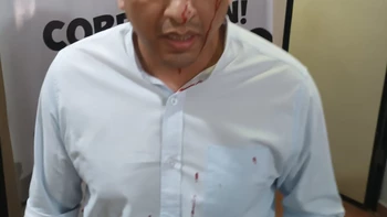 Una mujer agrede a un juez en Montero y le provoca una herida en la cabeza Una mujer agrede a un juez en Montero y le provoca una herida en la cabeza