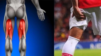 Lesión en los isquiotibiales, consecuencia del fútbol moderno Lesión en los isquiotibiales, consecuencia del fútbol moderno