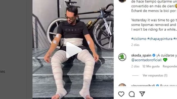 Extirpan a Alberto Contador más de cien tumores benignos (video) Extirpan a Alberto Contador más de cien tumores benignos (video)
